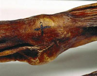 otzi mummia simbolo tatuaggio